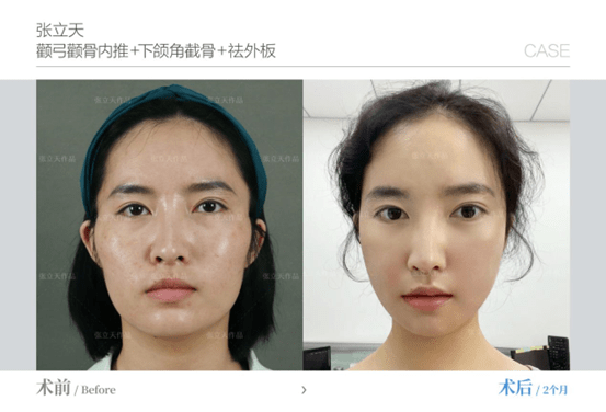 黑莓手机和华为哪个好
:李继华和张立天比哪个好-第1张图片-太平洋在线下载