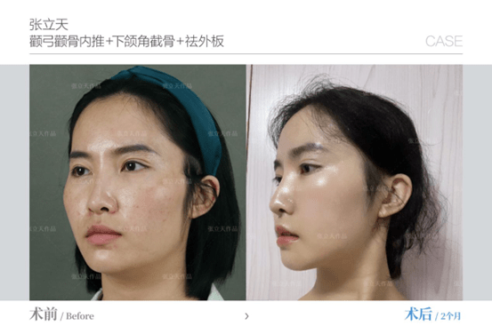 黑莓手机和华为哪个好
:李继华和张立天比哪个好-第2张图片-太平洋在线下载