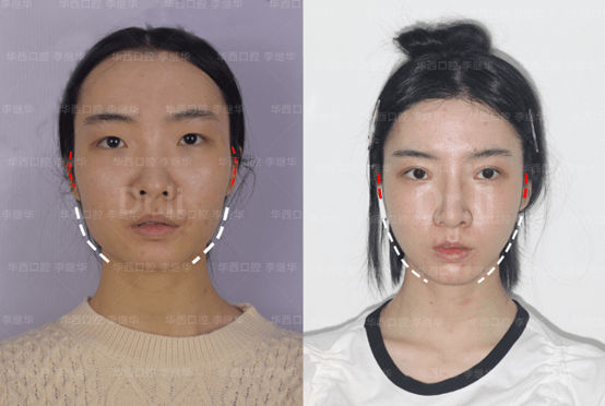 黑莓手机和华为哪个好
:李继华和张立天比哪个好-第3张图片-太平洋在线下载